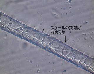 防縮ウールの顕微鏡写真