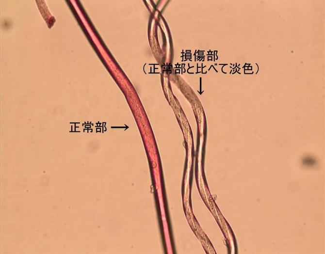 試薬による染色の程度を比較する顕微鏡写真