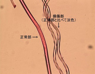 試薬による染色の程度を比較する顕微鏡写真